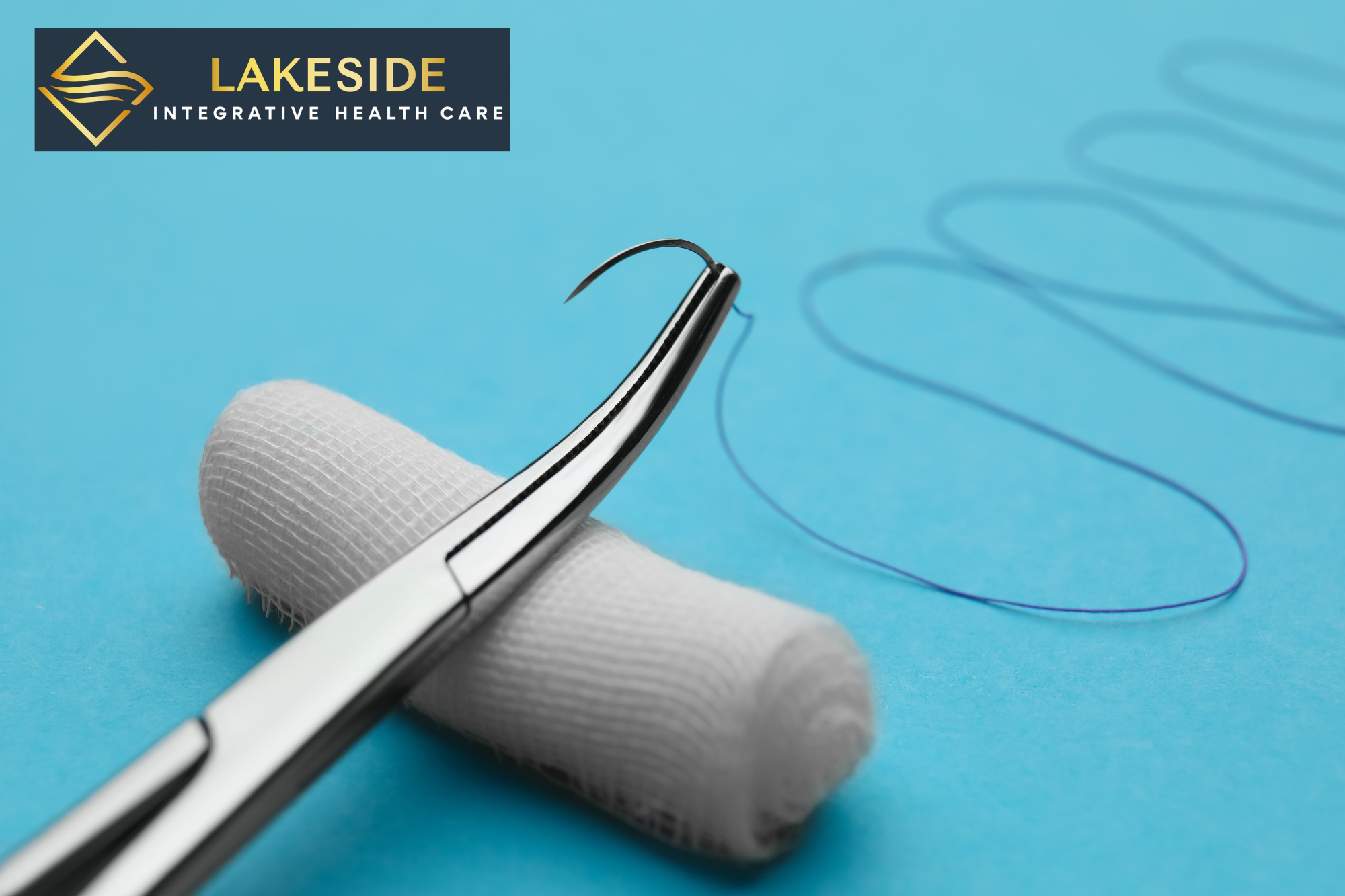 suture and staple removal charlotte